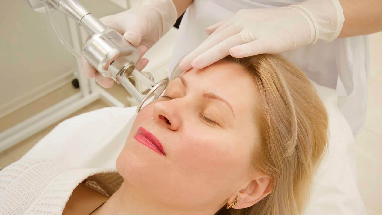 Laserski tretman za podmlađivanje kože lica